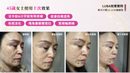 LU&BA | 家用膠原蛋白機 | LUBA | 鹿巴膠原蛋白儀 | 非侵入式 | 膠原蛋白儀 | 面部美容儀 | 淡斑美容機 | 雀斑 | 美白美容機 | 肌膚修復 | 家用護理儀