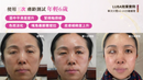 LU&BA | 家用膠原蛋白機 | LUBA | 鹿巴膠原蛋白儀 | 非侵入式 | 膠原蛋白儀 | 面部美容儀 | 淡斑美容機 | 雀斑 | 美白美容機 | 肌膚修復 | 家用護理儀